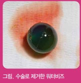 그림 1